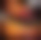 Image result for cornu cutaneum)