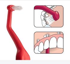 How to clean your removable retainer. Tepe Usa Oral Health Care On Twitter Tepe Universal Care Is A Unique Angled Brush To Enable Easy Access To Hard To Reach Areas Optimal For Retroclined Teeth Lingual Braces Retainers Or Implants