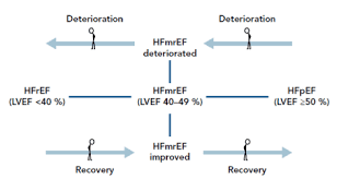 Heart Failure With Mid Range Ejection Fraction A Review Of