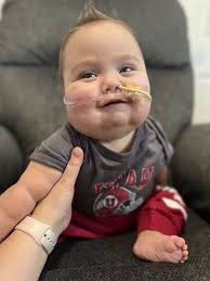 St. George baby boy survives despite rare fatal condition, awaits kidney  transplant
