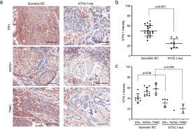 The average salary for cancer council employees in australia is au$72,526 per year. Evaluation Of The Association Of Heterozygous Germline Variants In Nthl1 With Breast Cancer Predisposition An International Multi Center Study Of 47 180 Subjects Npj Breast Cancer