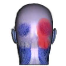 Pin On Symptoms Of Back Pain