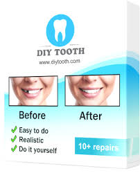 Here now a list of suggestions how to tackle the repair of your own tooth cavities in case you prefer (or have to) try doing without dental emergency treatment and/or proper dental work, i.e. Diy Tooth Replacement 4 Suggestions Diy Tooth