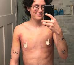 damien on X: before top surgery ur doctor has to draw circles around ur  tits so they dont get off task in the OR t.coCKLHRvG2nc  X