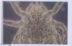 Image result for Trombicula autumnalis