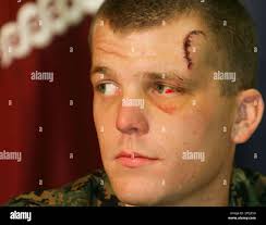 U.S. Marines Lance Cpl. Ryan Chapman, from Harlan, Kentucky, a machine  gunner of the 1st Battalion 3rd Marine Regiment, listens to a question  during a news conference at the Regional Medical Center