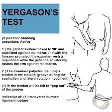 Image result for Yergason Test