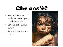 The last naturally occurring case was diagnosed in october 1977, and the world health organization (who) certified the global eradication of the disease in 1980. Il Vaiolo Una Battaglia Vinta Ppt Video Online Scaricare