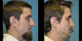 Lucy Barr, MD, Board Certified Facial Plastic Surgeon