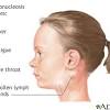 Your doctor can treat underlying causes of fatigue, but the feeling of being utterly worn out may persist despite treatments. 1