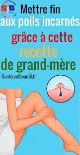 Mettre Fin Aux Poils Incarnes Grace A Cette Recette De Grand Mere En 2020 Poil Incarne Poil Sous Peau Sante Et Beaute