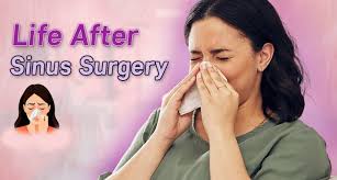 Image result for Sinus Surgery