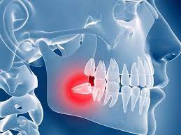 Pin On Dental Posts
