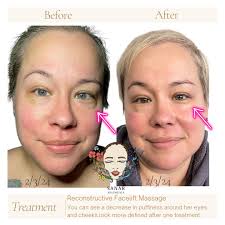 💫 Reconstructive Facelift Massage 💫 Everyone's results will of course be  different and the more consistent you are the more beneficial it will be.  The Reconstructive Facelift Massage was initially developed for