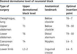 Landmarks For Epidural Anaesthesia And Analgesia Download