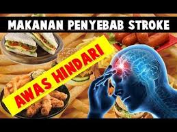 Inilah Makanan Penyebab Stroke Yang Harus Dihindari Video