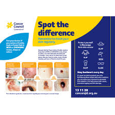 Patients in this study will be randomly assigned to receive radiation therapy and chemotherapy with or. Kaleidoscope Skin Cancer Clinic Bundaberg Prevention