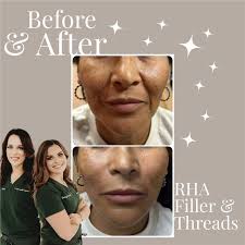Amber Howard Hines FNP💉Tox & Filler Queen of Texas (@hayesclinicspa) •  Instagram photos and videos