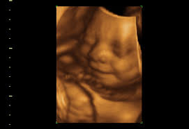 From listening to your baby's heartbeat for the first time, to finding out your baby's gender, and discovering. Ultrasound Orange Ca Ultrasound Clinic Near Me Fetal Memories 2d 3d 4d Ultrasound