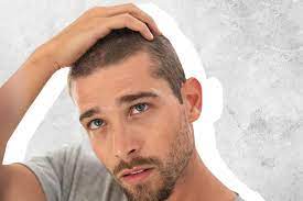 Ouai hair supplement for thinning hair. The Best Hair Loss Treatments For Men With Thinning Hair 2021 The Manual