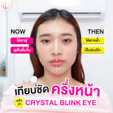 เทียบครึ่งหน้าแบบชัดๆ กันไปเลยค่ะทุกคน หลังทำ 𝓒𝓻𝔂𝓼𝓽𝓪𝓵 𝓑𝓵𝓲𝓷𝓴  𝓔𝔂𝓮 🤩 บอกเลยว่าหน้ากลับมาสดใสขึ้นทันตา . สดใสขึ้นทันทีหลังทำ  ไม่เสียเวลาพักฟื้น ! คุณหมอประเมิน + ให้คำแนะนำอย่างละเอียด รีวิวแน่นมาก  ทักแชทขอดูเพิ่มเติมได้เลยค่ะ . ที่ #อินชอน ...