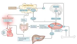 Image result for Cachexia in Cancer