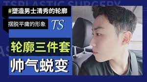 韩国TS男士面部轮廓三件套(颧骨+下颌角+下巴),不一样的花美男变身记