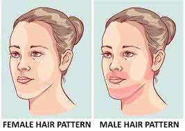 Visit your dermatologist to get a prescription for a hair inhibitor. A Guide To Excess Hair Growth In Women