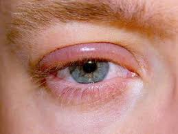 Image result for Blepharis cuanzensis