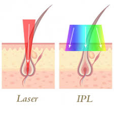 Initially, one would have to go to a professional clinic or salon which is expensive laser hair removal machines for home use are small and portable devices which work by treating the hair right down to the root with light energy that. Laser Hair Removal Advanced Beauty Therapy By Vittoria