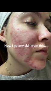 Nefer Esthetics Hanford Ca