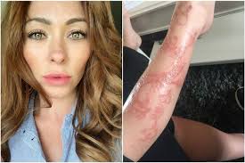 Black henna, however, contains an additive that is extremely dangerous. The Dangerous Reason You Should Never Consider Getting A Black Henna Tattoo Mirror Online