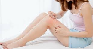 Image result for svrab na k%u016F%u017Ei