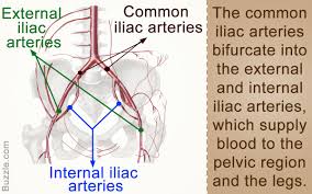 Er diagrams are created based on three basic concepts: The Abdominal Aorta Bifurcates At The Level Of The Fourth Lumbar Vertebra To Form The Two Common Iliac Arteries Each Arteries Anatomy Arteries Abdominal Aorta