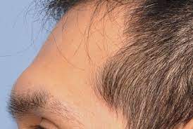 Pin On Face Reading