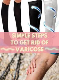 Diy Mask Diy Skin Care Recipes Simple Steps To Get Rid Of Varicose Diy Skin Care Recipes Diy Skin Care Skin Care Recipes