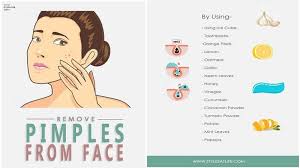 How To Remove Pimples Home Remedies Prevention Tips How To Remove Pimples Home Remedies For Pimples Pimples