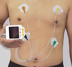 Bei einem ekg werden die elektrischen aktionen vom herz. Mobile Ekg Gerate 24 Stunden Langzeit Messung Oder 30 Sekunden Pc Software Holter Mit Kassenzulassung