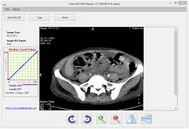 Download restore windows photo viewer to windows 10 1.22 for windows. Free Dicom Viewer Descargar