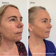 Ideal Women's Health Specialists