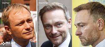 Nach dem eingriff verfüge er nun wieder über ausreichende haarreserven im bereich der raufstrategisch wichtigen geheimratsecken, so lindner, der somit als einziger liberaler in jüngster zeit beeindruckende zuwächse verzeichnen konnte. Haartransplantation Nur Fur Promis Das War Gestern Hair Transplant Plastic Surgery In Istanbul Turkey Mcan Health
