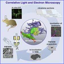 They regulate the water content in the blood. Label Free 3d Clem Using Endogenous Tissue Landmarks Sciencedirect
