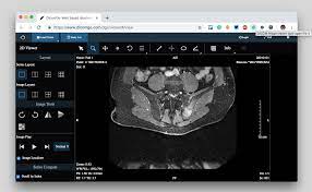 Check spelling or type a new query. 11 Best Free Online Web Based Cloud Dicom Viewers Services