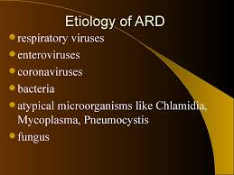 Acute Respiratory Diseases In Children Prezentaciya Onlajn