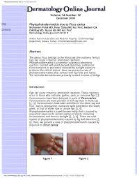 Check spelling or type a new query. Pdf Phytophotodermatitis Due To Ficus Carica