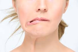 Bell S Palsy Facts Causes Symptoms Complications Treatment Factdr