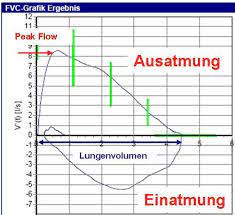 Lungenfunktionstest Diagram Quizlet