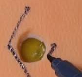 A cirurgia com retalho de romboide, também conhecida como retalho de  Limberg, é uma das técnicas mais utilizadas no tratamento cirúrgico do  cisto pilonidal, especialmente em casos recorrentes ou mais ...