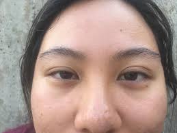 An epicanthic fold, epicanthal fold, or epicanthus is a skin fold of the upper eyelid (from the nose to the inner side of the eyebrow) covering the inner corner (medial canthus) of the eye. Double Beauty Standards I Am Adoptee