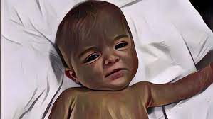 Fototerapi sangat efektif untuk mengobati bayi kuning dengan efek samping yang relatif ringan, seperti ruam atau diare. Tanda Bayi Kuning Sembuh Dan Ciri Cirinya Paragram Id